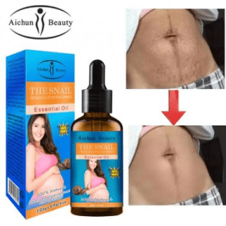 Aichun Beauty Huile essentielle naturel élimine les vergetures de grossesse  – Image 1