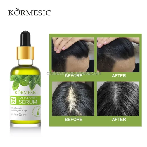 KORMESIC – huile d'argan , sérum de croissance des cheveux pour hommes et femmes – Image 1